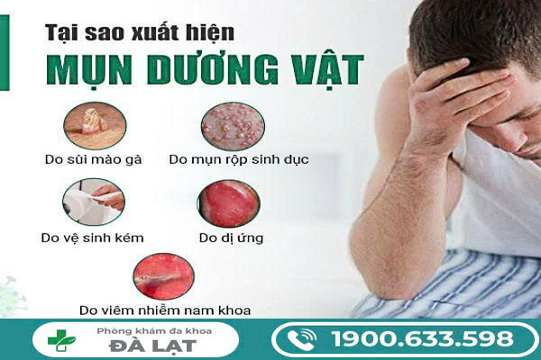 Hình ảnh minh họa